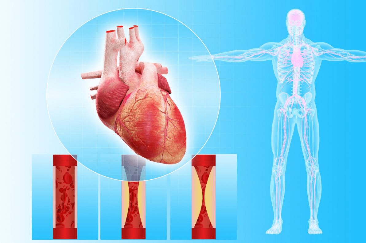 多发性脂囊瘤最新治疗方法,探索多发性脂囊瘤治疗领域的最新突破技术＂。