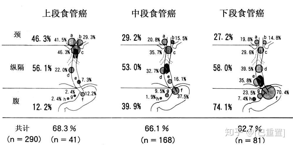 揭秘食管最新分段标准2017：挑战传统，探索新境界，警示肺炎灌肠风险